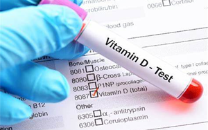 25-羥基維生素D-磁微?；瘜W(xué)發(fā)光法（AE/AP） /熒光免疫層析解決方案（雙抗體夾心法）