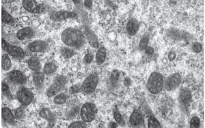 《科學轉(zhuǎn)化醫(yī)學》：2型糖尿病患者的肌肉能量產(chǎn)生是如何受損的