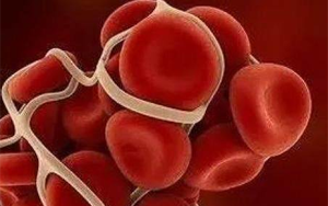 胃蛋白酶原II（PGII）-磁微?；瘜W(xué)發(fā)光法（AE/AP）/熒光免疫層析解決方案（含保護(hù)劑評估）