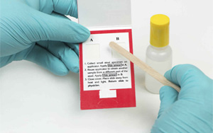 大便隱血（FOB）-免疫層析（膠體金、彩色乳膠及熒光免疫層析）解決方案