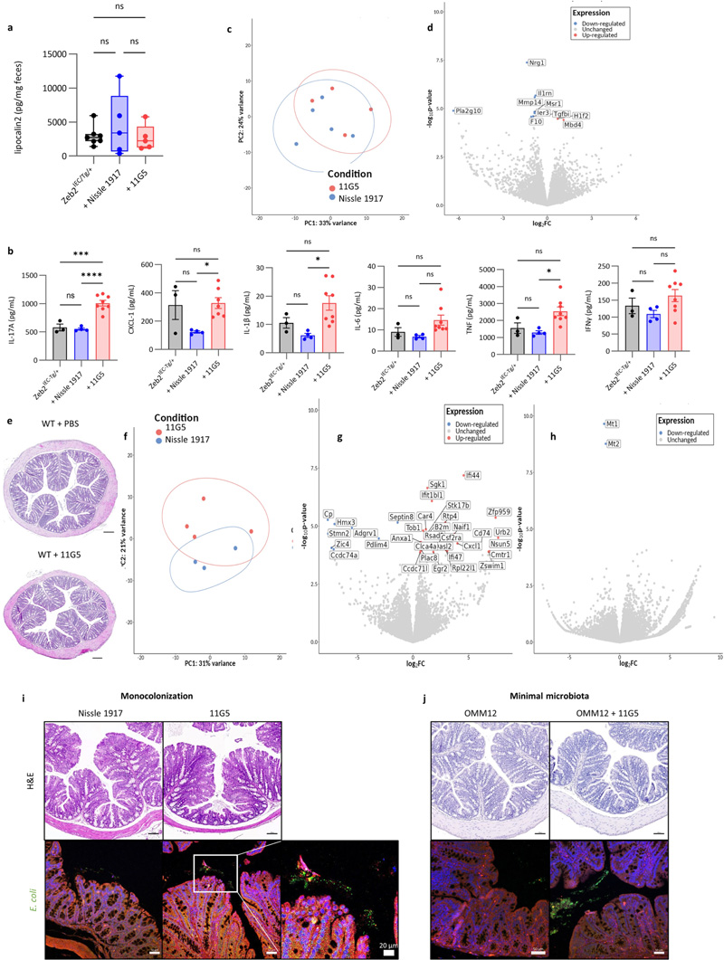 
大腸桿菌11G5感染不會增加Zeb2 IEC-Tg/+小鼠的結(jié)腸炎癥，也不會影響WT同窩小鼠的上皮細胞