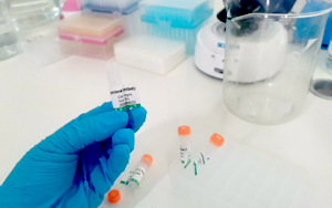 抗體稀釋緩沖液選擇及應(yīng)用