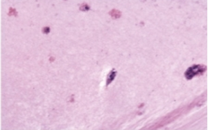 支原體清除試劑：解決細(xì)胞培養(yǎng)中支原體污染問題的利器