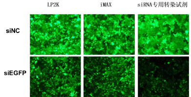 穩(wěn)定表達(dá)GFP的HeLa-EGFP細(xì)胞，沉默siEGFP，48h后熒光拍照