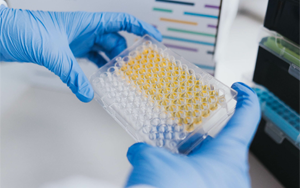 免疫技術(shù)新視界：層析、印跡、吸附與比濁的前沿碰撞