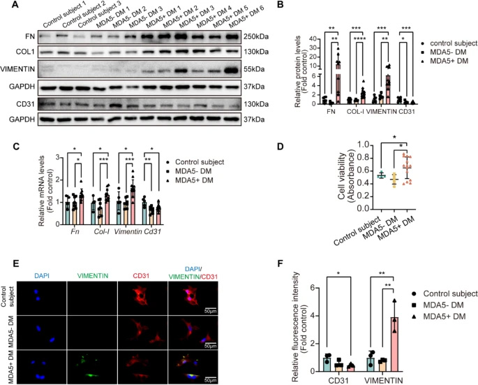 MDA5陽性皮肌炎患者血清可誘導(dǎo)原代小鼠肺微血管內(nèi)皮細(xì)胞發(fā)生內(nèi)皮-間質(zhì)轉(zhuǎn)化