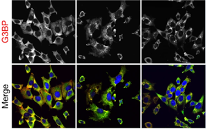 《Nature》細(xì)胞的應(yīng)激反應(yīng)比科學(xué)家認(rèn)為的更細(xì)微、更分散