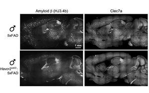Nature：在大腦免疫細(xì)胞中發(fā)現(xiàn)潛在的阿爾茨海默病治療靶點