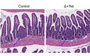 Nature：科學(xué)家新發(fā)現(xiàn)一種免疫細(xì)胞類型，與過敏有關(guān)
