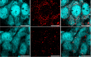 重大發(fā)現(xiàn)！阿爾茨海默病患者來源的高分子量 tau 蛋白如何 “破壞” 海馬神經(jīng)元？