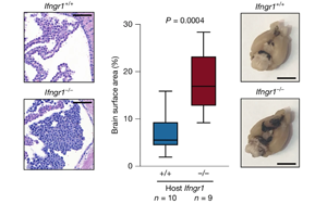 干擾素 -γ（IFNγ）調(diào)控軟腦膜抗腫瘤免疫應(yīng)答的機制研究