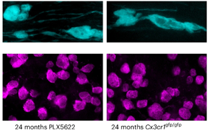 《Nature Neuroscience》大腦白質(zhì)為何隨年齡退化？因為免疫細胞“勾心斗角”