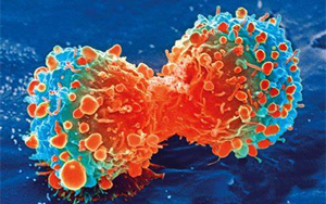 Nature Genetics：腫瘤轉(zhuǎn)移過(guò)程中會(huì)積累更多的拷貝數(shù)變異，而不是突變