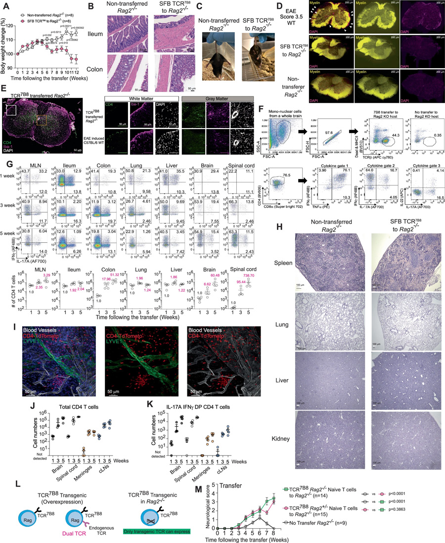 轉(zhuǎn)移的TCR7B8 CD4 T細胞在腸道和中樞神經(jīng)系統(tǒng)中擴增并展現(xiàn)致病活性 轉(zhuǎn)移的TCR7B8 CD4 T細胞在腸道和中樞神經(jīng)系統(tǒng)中擴增并展現(xiàn)致病活性