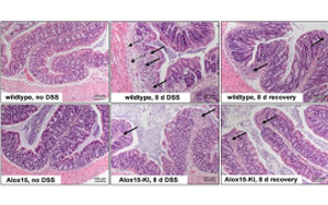 ALOX15功能人源化通過提升RvD5生成緩解小鼠結(jié)腸炎但不影響足爪水腫的機(jī)制研究