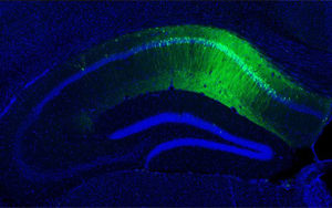 5-羥色胺(5-HT)通過調(diào)節(jié)腸道菌群-免疫軸改善加速度暴露誘導(dǎo)的大鼠腸腦軸功能障礙及認(rèn)知損傷