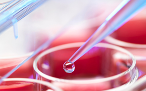 無血清細(xì)胞培養(yǎng)基原料大集合