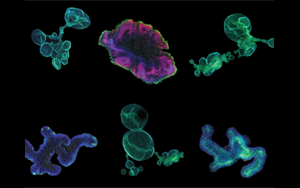 藥物研發(fā)的未來——類器官技術(shù)