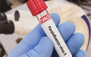 副流感病毒（HPIV1、2、3型）抗原檢測-免疫層析 （膠體金、彩色乳膠及熒光免疫層析）解決方案