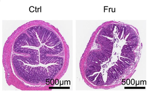高果糖飲食通過(guò)代謝重編程促進(jìn)效應(yīng)T細(xì)胞生成加劇炎癥反應(yīng)的作用機(jī)制及二甲雙胍干預(yù)研究