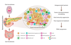 JAMA Oncology：口腔微生物群與胰腺癌風(fēng)險相關(guān)