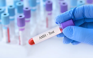 抗繆勒管激素（AMH）-磁微?；瘜W(xué)發(fā)光法（AE/AP） +熒光免疫層析解決方案