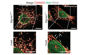 核糖核苷酸滲入線粒體DNA驅(qū)動炎癥反應(yīng)——揭示核苷酸代謝失衡引發(fā)年齡相關(guān)性炎癥的新機制