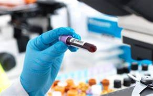 【FAPGG】，血管緊張素轉(zhuǎn)換酶檢測用底物