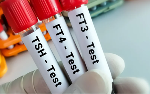 總及游離甲狀腺素（TT4及FT4）-磁微?；瘜W(xué)發(fā)光法（AE/AP）解決方案（雙抗體夾心法）