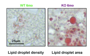 α-酮戊二酸通過調(diào)控胰島素-ATM信號(hào)軸改善共濟(jì)失調(diào)毛細(xì)血管擴(kuò)張癥小鼠模型的胰島素抵抗和代謝紊亂