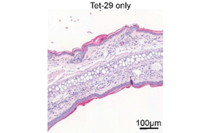 Science Signaling：深入了解糖類如何調(diào)節(jié)炎癥性疾病過程