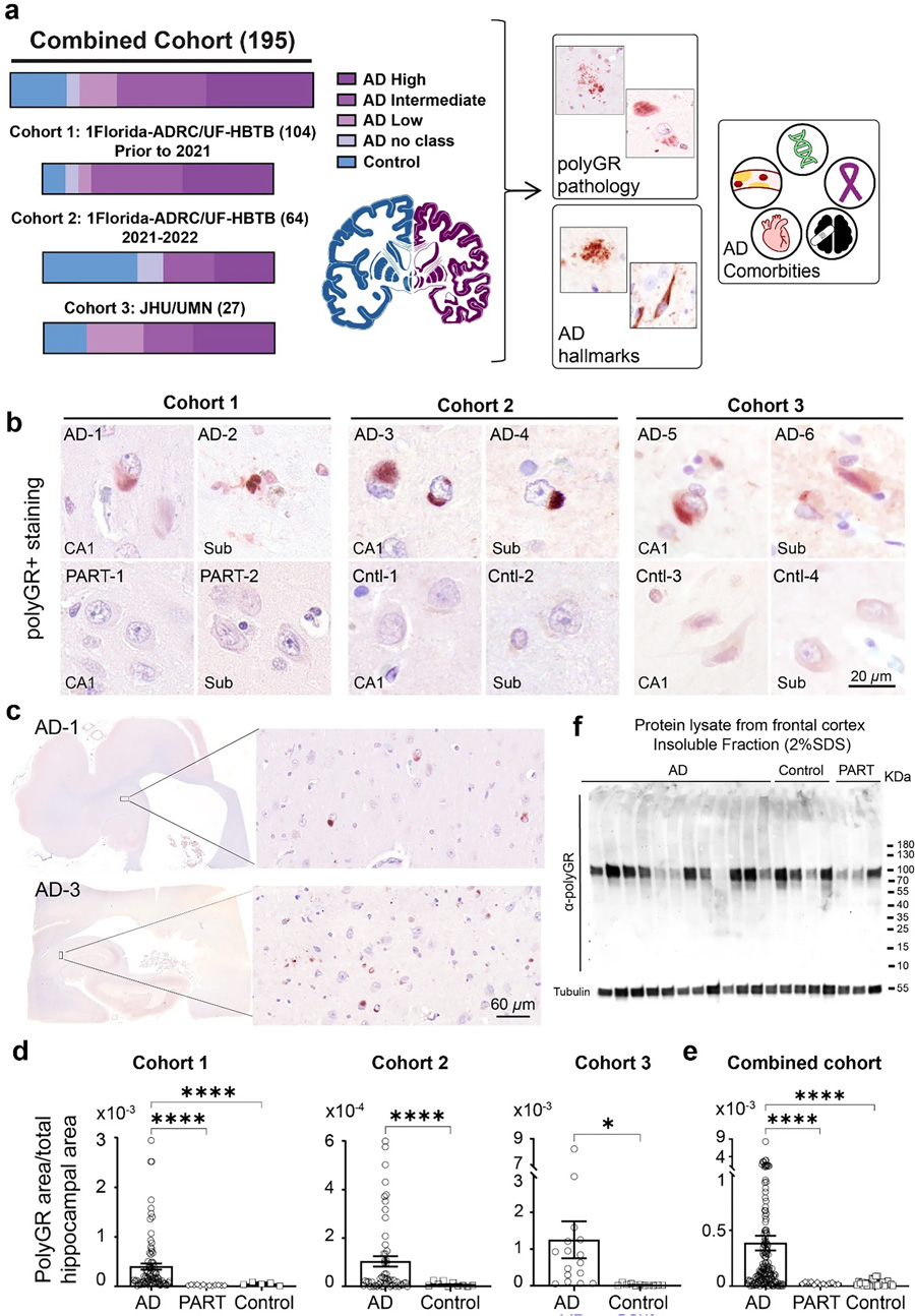 在多組阿爾茨海默病尸檢腦樣本中，海馬體頻繁檢測到PolyGR+?蛋白聚集物