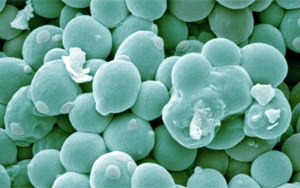 工程化產(chǎn)丁酸酵母通過(guò)協(xié)同作用改善阿爾茨海默病相關(guān)表型