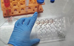 精準(zhǔn)營養(yǎng)，塑造未來：類器官培養(yǎng)基的新紀(jì)元