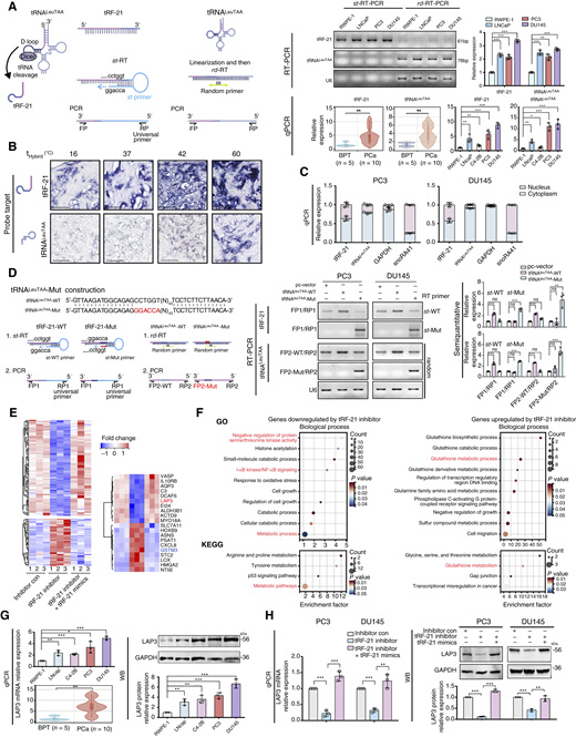 前列腺癌中tRNALeuTAA來源的小RNA tRF-21的鑒定、表征及其靶基因研究