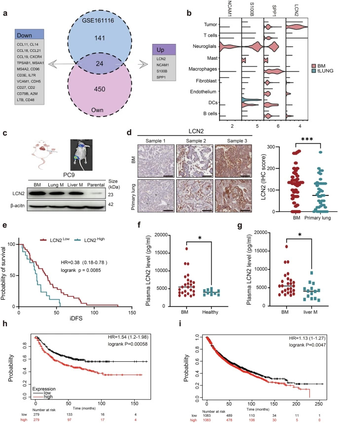 LCN2在腦轉(zhuǎn)移組織中過(guò)表達(dá)，且與肺癌患者的不良預(yù)后相關(guān)
