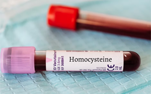 同型半胱氨酸（HCY）-磁微?；瘜W(xué)發(fā)光法（AE/AP） +熒光免疫層析解決方案