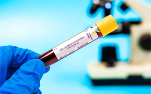 人附睪蛋白4（HE4）-磁微?；瘜W發(fā)光法（AE/AP） /熒光免疫層析解決方案