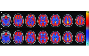 AJCN：要長壽，常吃豆！長期食用大豆飲食可讓大腦“更靈光”