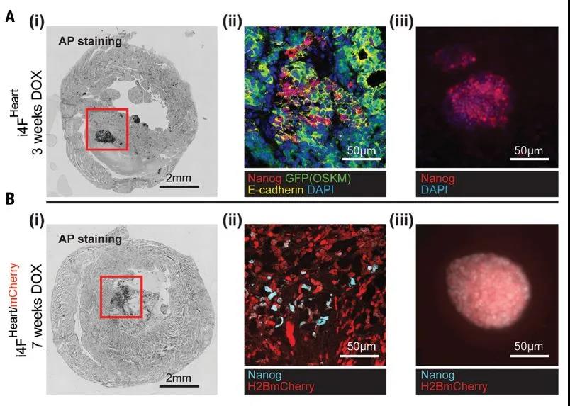 Science重磅：局部重編程讓心肌細(xì)胞“返老還童” 讓心臟實(shí)現(xiàn)再生！