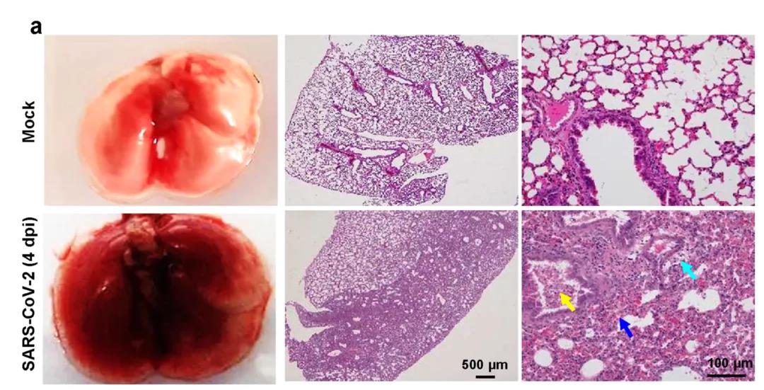 ?建模成功！Nature子刊：成功建立新冠肺炎重癥模型，揭示新冠病毒感染的分子機(jī)制
