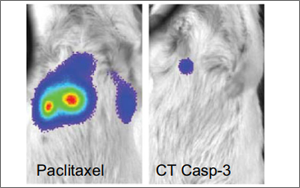 Nature子刊：用細(xì)菌遞送藥物到癌細(xì)胞內(nèi)，有效治療肝癌和乳腺癌
