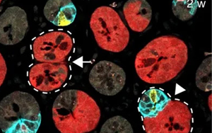 Nature 三連重磅！識破癌細胞的“詭計”，為結(jié)直腸癌患者帶來新希望