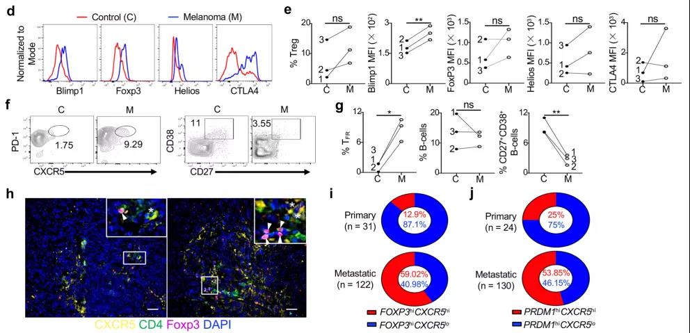 如何重塑腫瘤微環(huán)境，強(qiáng)化抗PD-1療效？Treg細(xì)胞的Blimp1表達(dá)是關(guān)鍵！