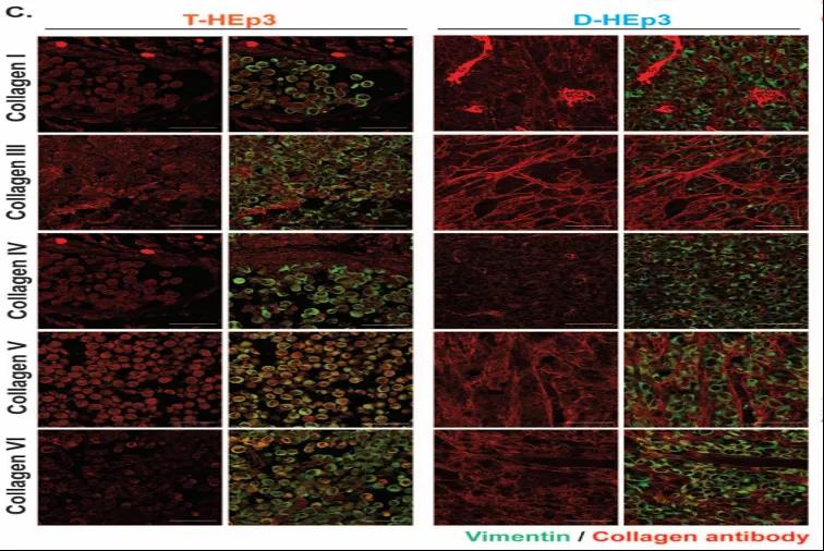 讓癌細(xì)胞“一睡不醒”！向腫瘤微環(huán)境中添加III型膠原蛋白可防止腫瘤復(fù)發(fā)和轉(zhuǎn)移