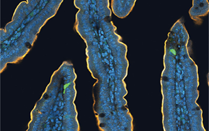 喝完無(wú)糖飲料還想吃甜食？人們對(duì)糖的渴望，無(wú)法被甜味劑替代，答案都在腸道里！