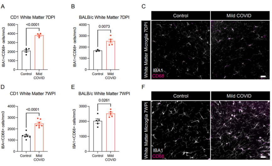 新冠竟能“傷腦”？耶魯科學家找到SARS-CoV-2損害神經系統(tǒng)新證據