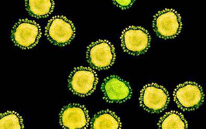 傳播速度快！新變體BA.2.12.1“風(fēng)靡”北美