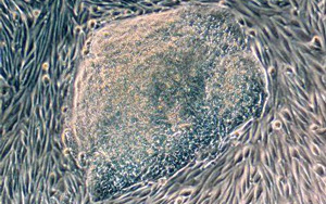 首次發(fā)現(xiàn)人類尿液來源的干細胞具有強大的再生潛力！