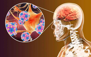 nOPV2的改良疫苗用于全球根除脊髓灰質(zhì)炎全球行動(dòng)計(jì)劃